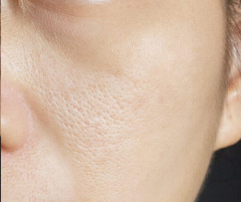 After - Smooth & Clear Skin