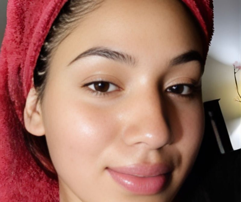 After - Dark spots se nijaat